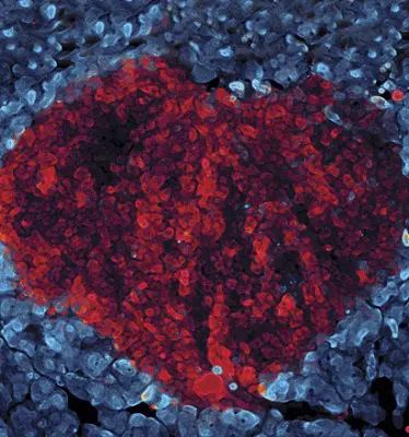 Mouse pancreatic tumor